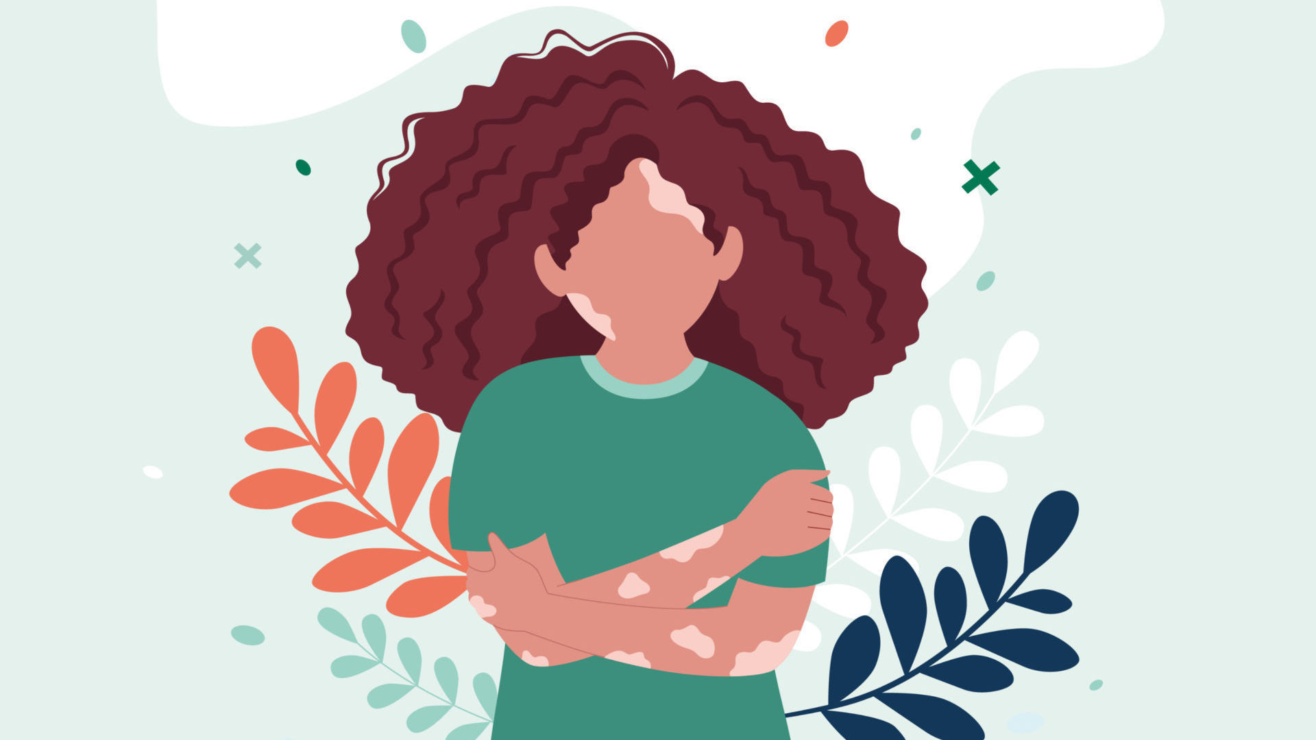 Vitiligine quali sono le cause e come si cura Humanitas