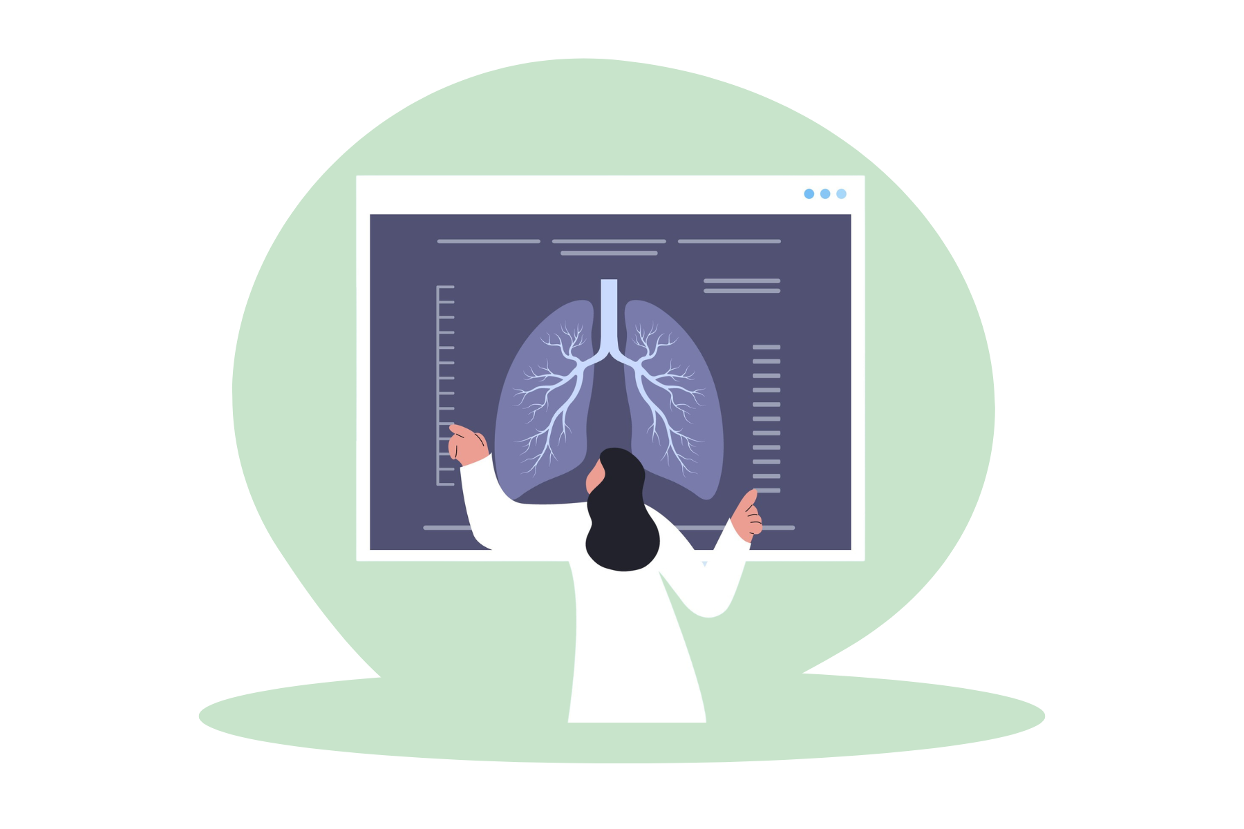 Tumore al polmone: quando è indicata la terapia post-operatoria?