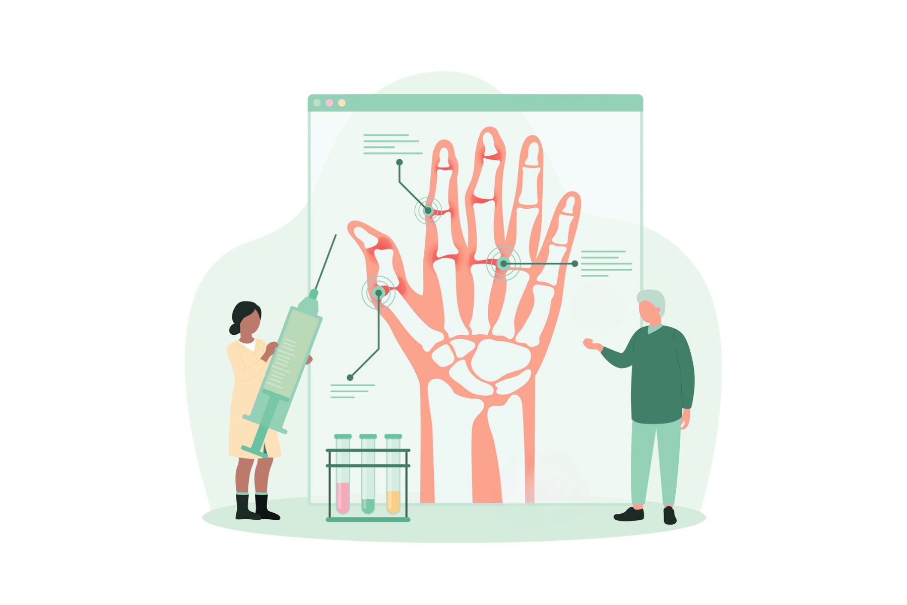 Artrosi di mano e polso: cause e sintomi