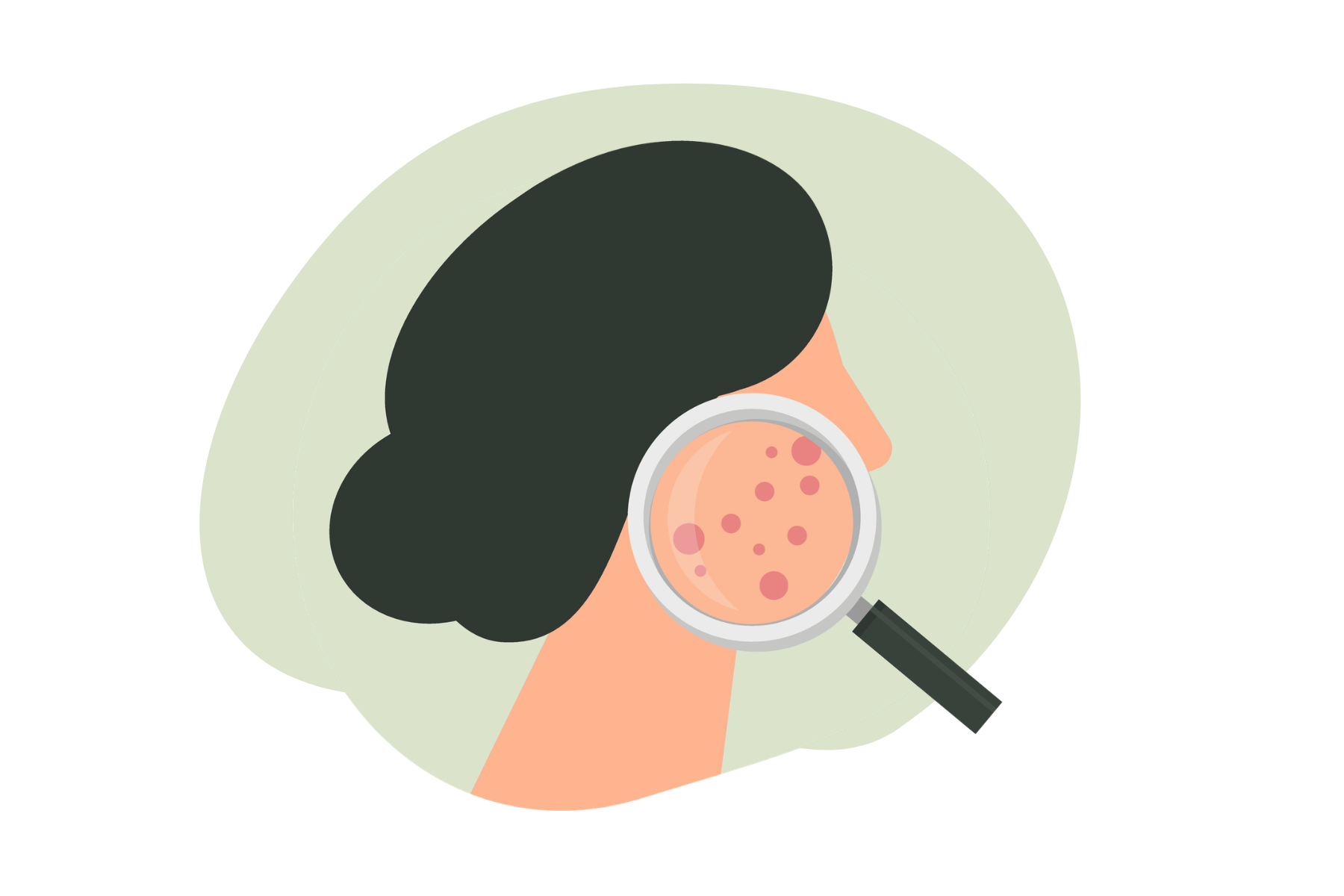 Acne: c'è un legame con stress e alimentazione?